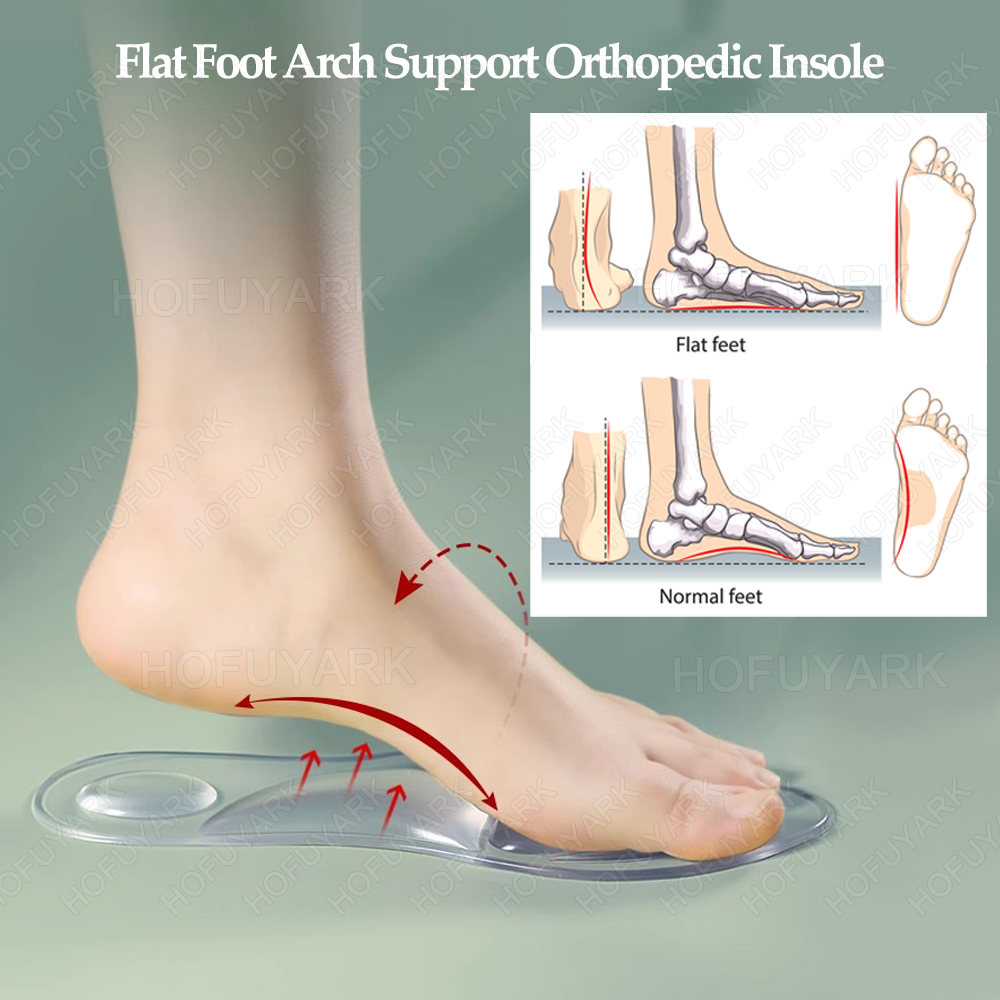 Silikon Gel Einlegesohlen Orth – Women'S Shoes Plantar Fasciitis Bewertung und Preis